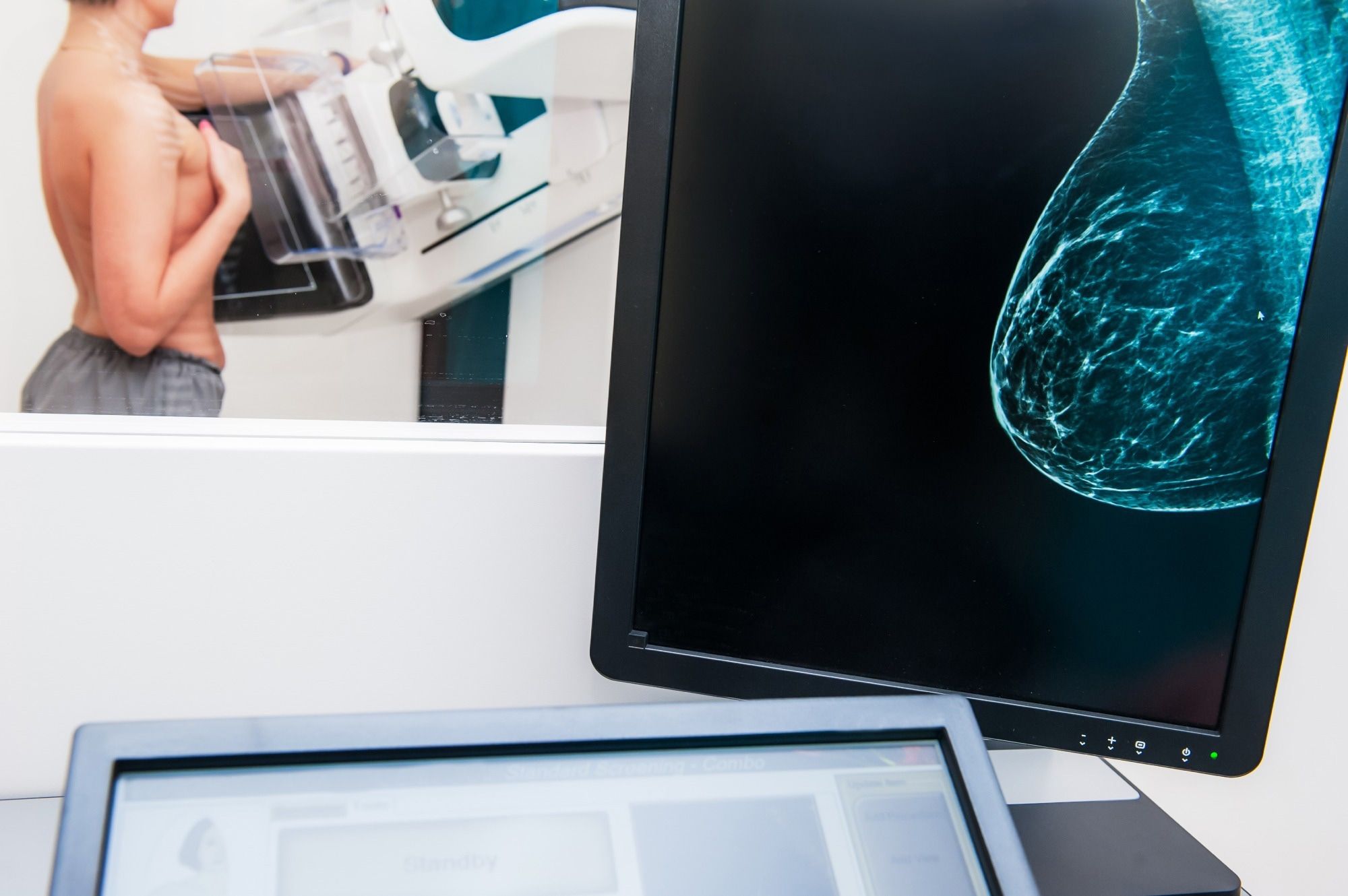 AI Algorithm Shows Promise in Early Detection of Breast Cancer from ...