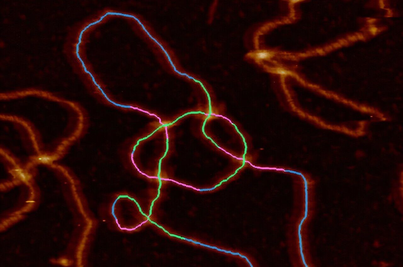 AI and Advanced Microscopy Revolutionize DNA Tangle Visualization