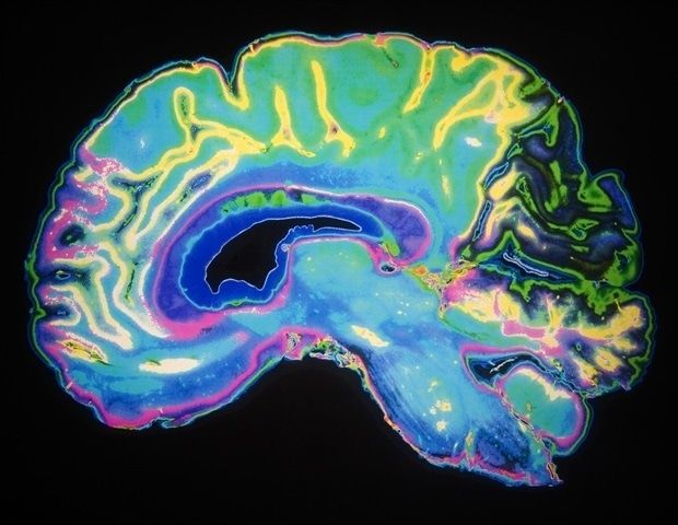 AI Epilepsy Detection Finds Early Warning Signs in EEG